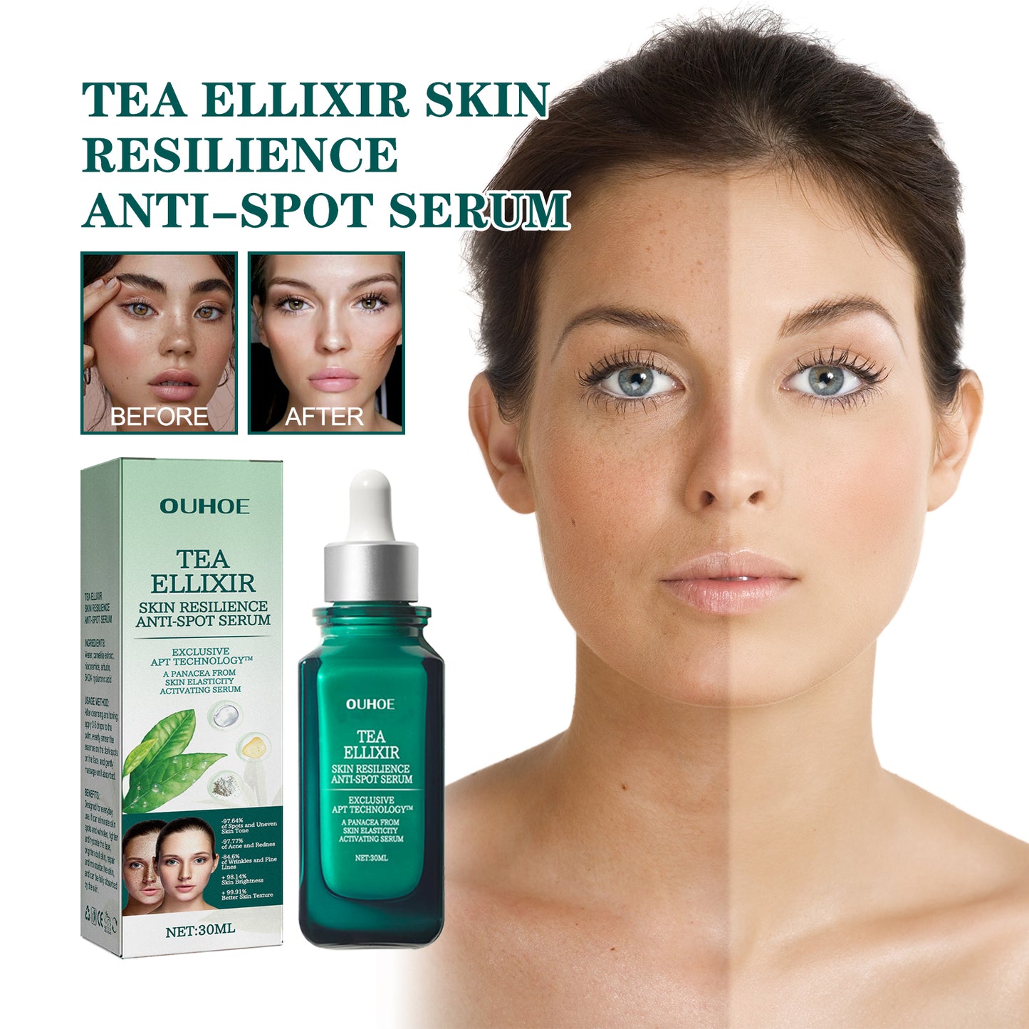 Brightening Blemish Essence, Lightening Melasma Blemish Hydrating And Brightening Skin Essence