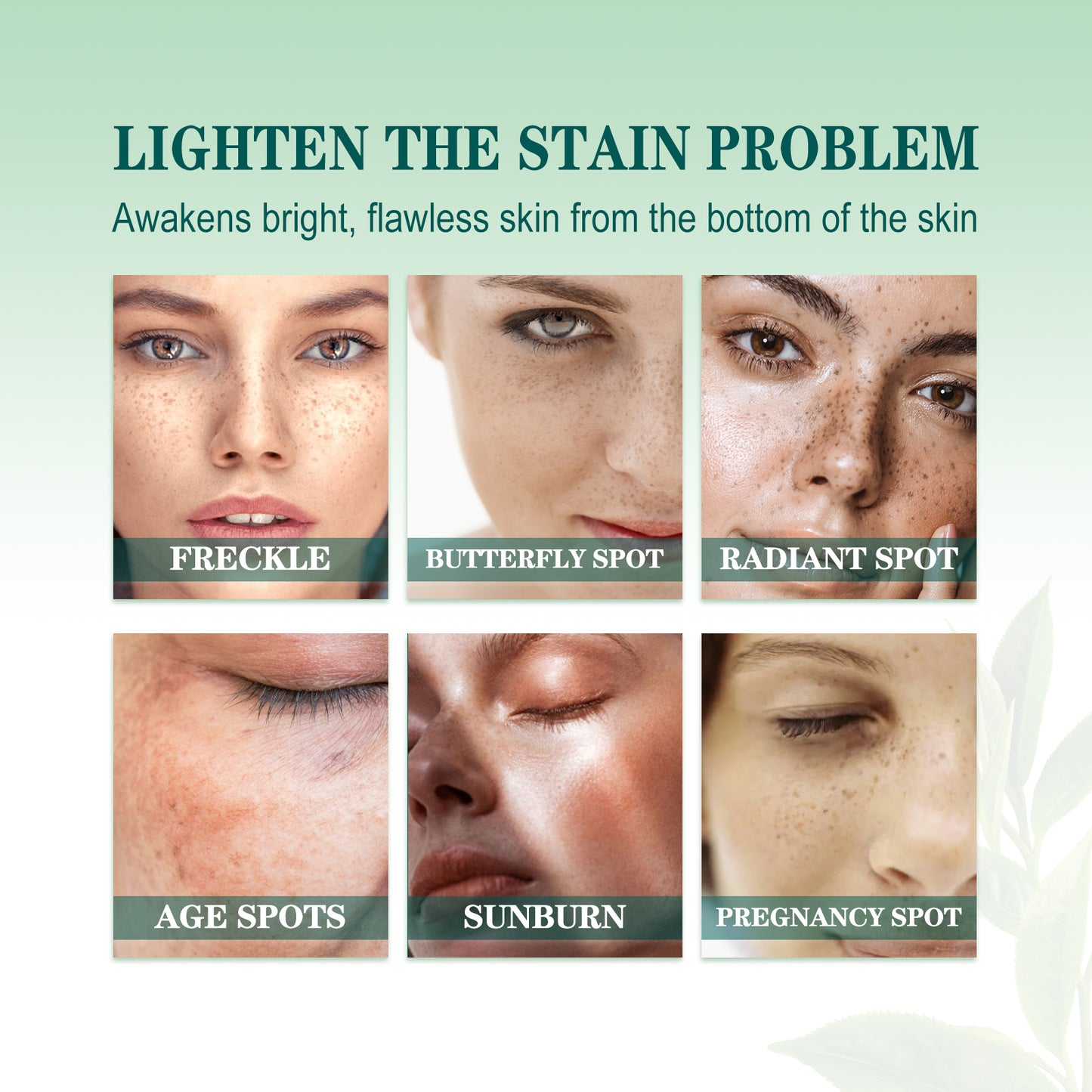 Brightening Blemish Essence, Lightening Melasma Blemish Hydrating And Brightening Skin Essence